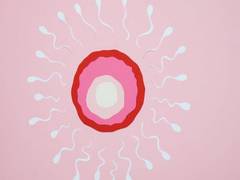 
      
      Infertility or pregnancy loss can increase women's risk of stroke
      
      