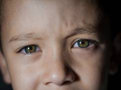 
      
      Study reveals brain-related visual problems may affect one in...
      
      