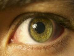 
      
      New insights about age-related macular degeneration could...
      
      