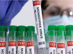 
      
      India records another two monkeypox cases
      
      