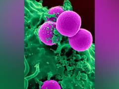 
      
      Research finds bacteria that increase risk of pancreatic cancer
      
      
