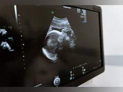 
      
      Engineers designed stamp-sized ultrasound imaging device
      
      