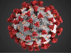 
      
      Study identifies risk factors for severe COVID-19 in...
      
      