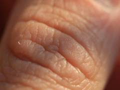
      
      Researchers claim to have discovered a new pain organ in skin
      
      