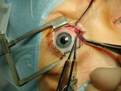 
      
      Gene therapy effective for treating wet age-related macular...
      
      
