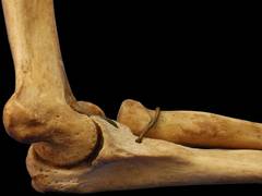 
      
      Humans too can repair their joints like salamanders,...
      
      