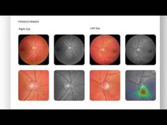 
      
      Remidio's Medios AI shows significant promise 
      
      