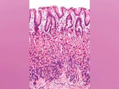 
      
      Gut cells sound the alarm when parasites invade, says study
      
      