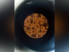 
      
      Brown fat may protect against chronic diseases: Study
      
      