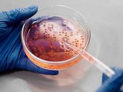 
      
      Loss of circadian regulation allows for increase in glucose...
      
      