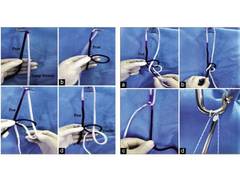 
      
      Doctor at Sakra World Hospital invents a new form of Arthroscopy 
      
      