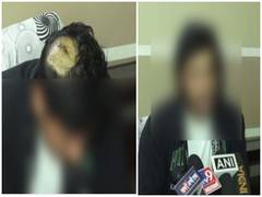 
      
      Unsatisfied with police action in case, says couple attacked...
      
      