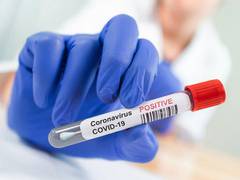 
      
      Goa logs 215 new COVID-19 cases, 7 deaths
      
      