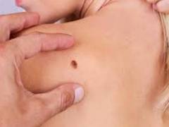 
      
      New approach to fight metastatic melanoma discovered by...
      
      
