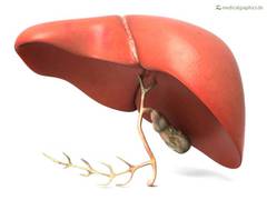 
      
      Study examines development of fatty liver disease under...
      
      