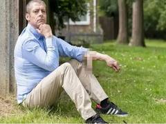 
    Man had penis attached to his arm for six years
    