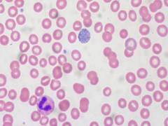 
      
      Study reveals deadliest malaria strain protects itself from ...
      
      