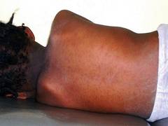 
      
      DRC faces bout of epidemic that has killed more than 6,000 already
      
      