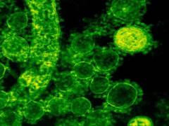 
      
      Gut microbiota may change response to cancer treatment
      
      