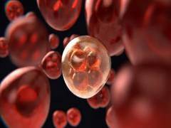 
      
      Study suggests liquid biopsy for colorectal cancer could...
      
      