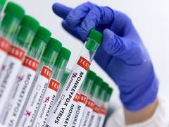 
      
      Monkeypox cases in Europe tripled in last 2 weeks
      
      