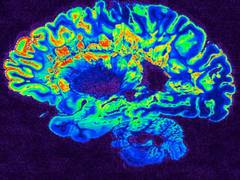 
      
      Brains of adolescents with mental health problems wired...
      
      