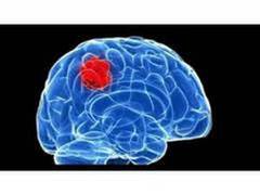 
      
      Study reveals cellular 'hotspots' in brain may signify...
      
      