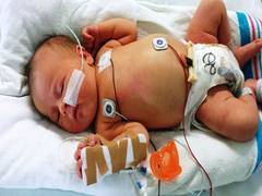 
    Family of kids with life-threatening diseases more likely to suffer mentally, physically
    