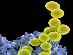 
      
      Study discovers enzyme that may prevent streptococci infection
      
      