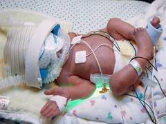 
      
      Newborns admitted to NICUs vulnerable to mental disorders in...
      
      