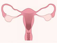 
      
      Study reveals secret hideouts of ovarian cancer 
      
      