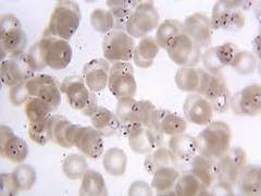 
      
      Unusual parasite metabolism, a ray of hope against...
      
      