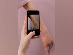 
      
      Researchers study why moles become melanomas
      
      