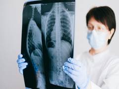 
      
      Researchers discover new cell type in human lungs
      
      