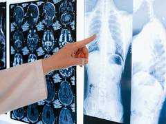 
      
      Antifungal preventive drugs reduce mortality risk following...
      
      