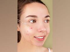 
      
      Researchers discover new method for treating skin infections
      
      