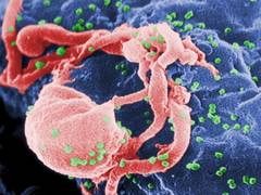 
      
      Young HIV patients have lower viral suppression rates than...
      
      
