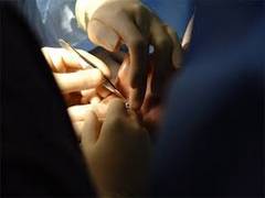 
      
      Delhi witnesses around 76 cases of firecracker eye injuries...
      
      