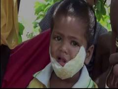 
      
      Man sells phone for daughter's treatment after govt hospital...
      
      