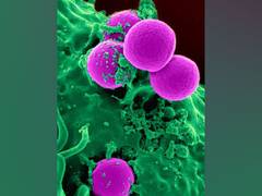 
    Cells burn more calories after just one bout of moderate aerobic exercise, study finds
    