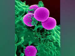 
      
      Membrane proteins of bacteria, humans show surprising similarities
      
      