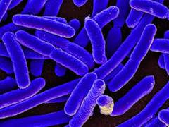 
      
      Deadly 'superbugs' destroyed by molecular drills: Study
      
      
