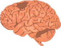 
      
      Study focuses on molecular map of brain's decision-making area
      
      