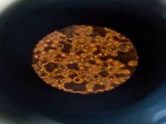 
      
      Future risk of ALS linked to blood lipoprotein levels
      
      