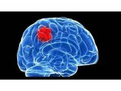 
      
      Study finds treatment for brain disease transmitted by tick bites
      
      