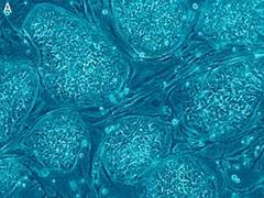 
      
      Scientists develop artificial muscle sheets to transform stem...
      
      
