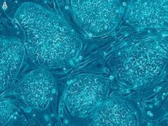 
      
      Researchers find a new treatment for rare muscular disease
      
      