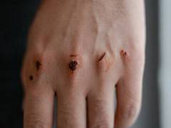 
      
      Research suggests minerals might be key to healing damaged tissue
      
      