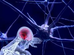 
      
      Schizophrenia patients have low levels of SV2A proteins in...
      
      