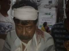 
      
      Two BJP workers injured in clashes with TMC in Burdwan
      
      
